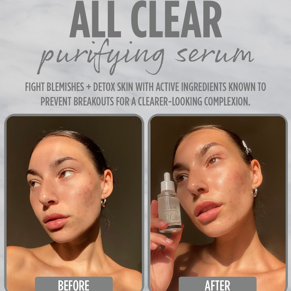All Clear Purifying Serum - Image 3